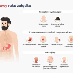 Ilustracja przedstawia objawy raka żołądka: utratę masy ciała, czarne stolce, uczucie pełności, niestrawność, zgagę, utratę apetytu, nudności, wymioty, osłabienie, ból pleców i trudności w połykaniu.