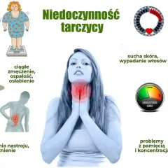 Niedoczynność tarczycy objawy: przyrost masy ciała, zmęczenie, bóle mięśni, wahania nastroju, sucha skóra, wypadanie włosów, problemy z pamięcią.
