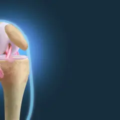 Anatomical illustration showing the complex structure of the więzadła w kolanie, highlighting their role in knee joint stability.