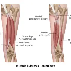 Anatomia mięśni uda: mięsień półścięgnisty i półbłoniasty, głowy mięśnia dwugłowego uda.