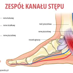 Ilustracja pokazuje anatomię stopy i łydki, z zaznaczonym nerwem piszczelowym, który może być uciśnięty w zespole kanału stępu.