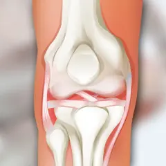 Anatomia stawu kolanowego: kości udowa i piszczelowa, rzepka oraz więzadła.