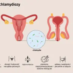 Ilustracja przedstawia układ rozrodczy kobiety i mężczyzny, powiększenie z bakteriami chlamydii oraz ikony symbolizujące objawy chlamydiozy: ból przy oddawaniu moczu, obrzęk narządów płciowych, ropę w moczu, plamienia i bolesne miesiączki, upławy, swęd...