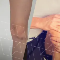 Anatomia kolana po lewej, po prawej osoba trzymająca się za bolące kolano.