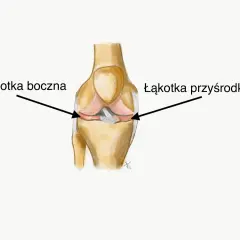 Ilustracja przedstawia budowę stawu kolanowego z zaznaczoną łąkotką boczną i przyśrodkową.