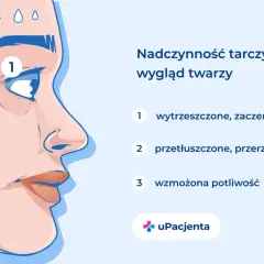 Nadczynność tarczycy objawy: wytrzeszczone oczy, przetłuszczone włosy i wzmożona potliwość.