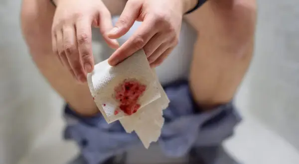 Dłoń trzymająca papier toaletowy z widoczną krwią. To niepokojący objaw, który może wskazywać na krew w stolcu.