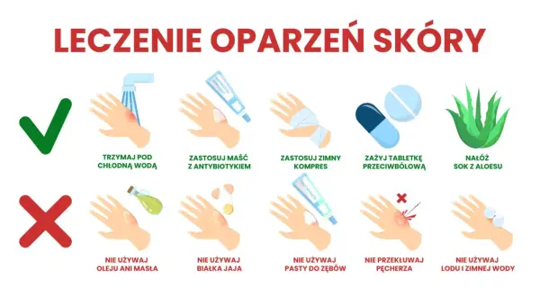 Instrukcja leczenia oparzeń skóry: chłodna woda, maść z antybiotykiem, zimny kompres, leki przeciwbólowe, aloes. Unikaj masła, jajka, pasty do zębów, lodu.