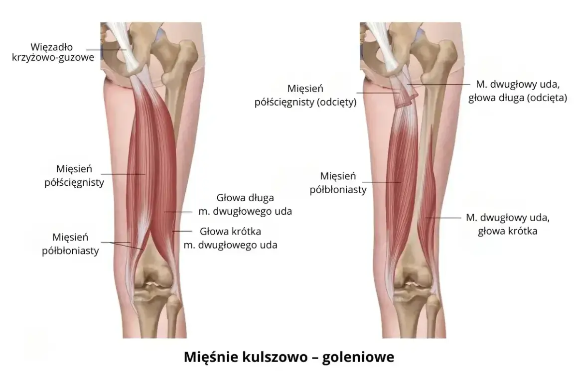 Anatomia mięśni uda: mięsień półścięgnisty i półbłoniasty, głowy mięśnia dwugłowego uda.