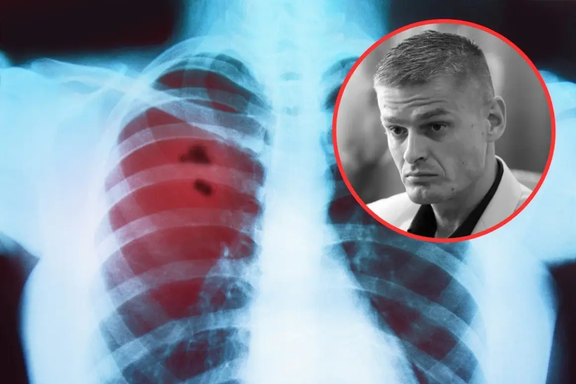 Rentgen klatki piersiowej z zaznaczonymi zmianami, sugerującymi raka płuc. Objawy mogą być subtelne.
