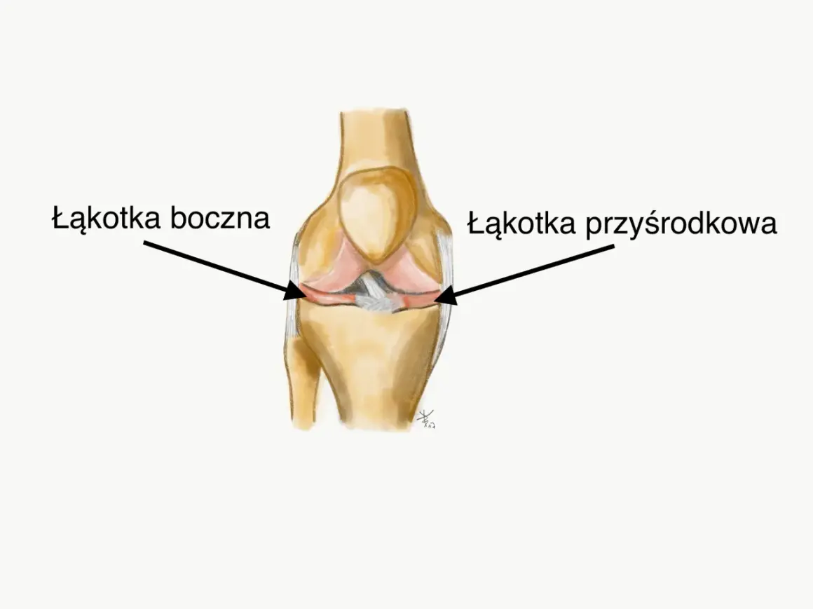 Ilustracja przedstawia budowę stawu kolanowego z zaznaczoną łąkotką boczną i przyśrodkową.