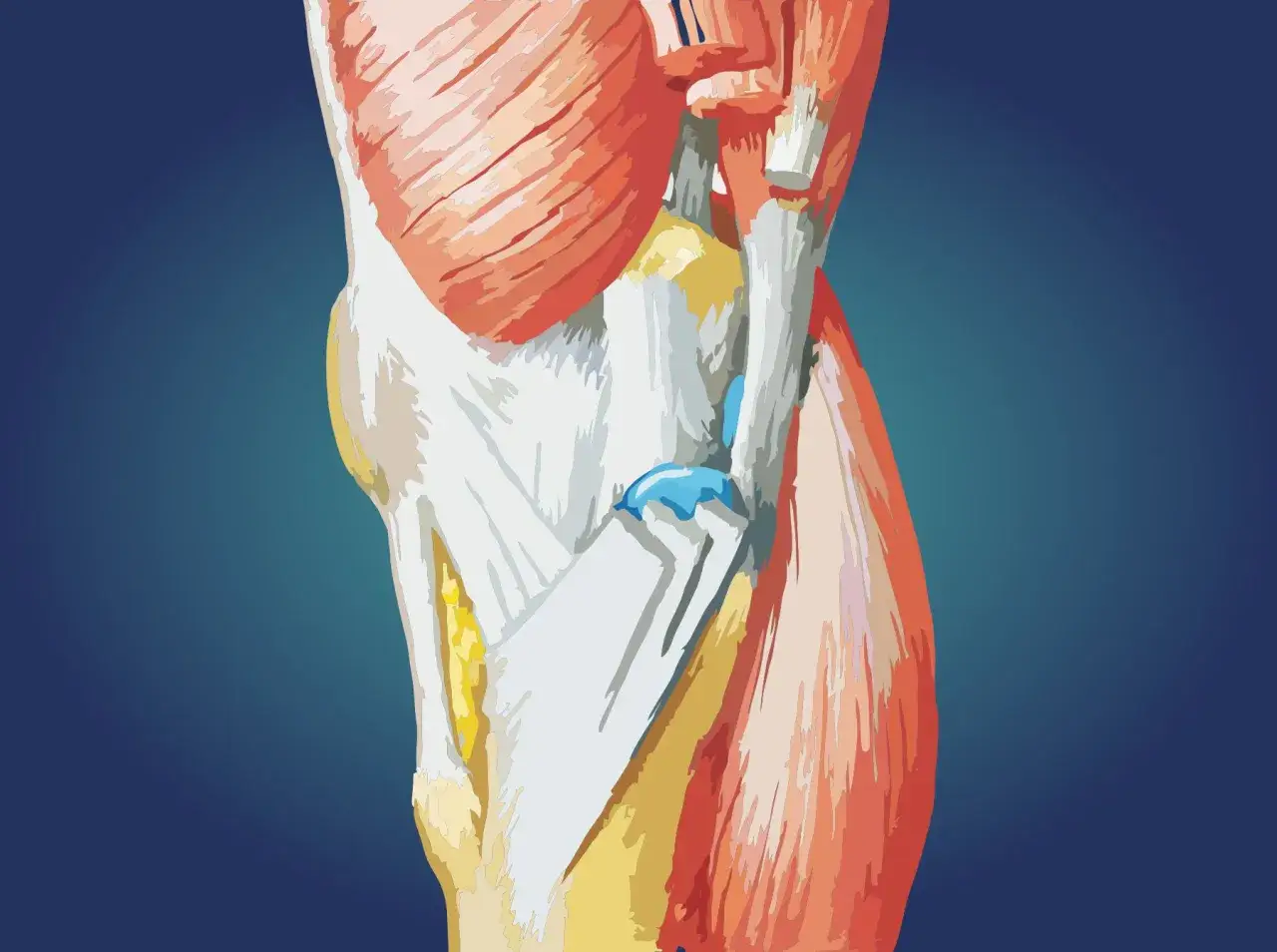 Anatomia kolana z widocznymi mięśniami i ścięgnami. Widać fragment mięśnia czworogłowego uda oraz ścięgna tworzące gęsią stopkę.