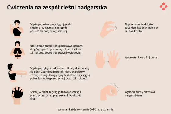 Zespół cieśni nadgarstka - objawy, diagnoza i leczenie