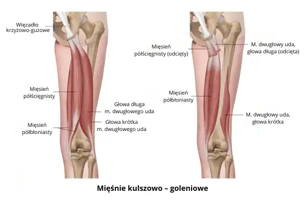 Anatomia mięśni uda: mięsień półścięgnisty i półbłoniasty, głowy mięśnia dwugłowego uda.