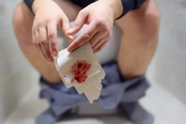 Dłoń trzymająca papier toaletowy z widoczną krwią. To niepokojący objaw, który może wskazywać na krew w stolcu.