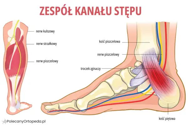Ilustracja pokazuje anatomię stopy i łydki, z zaznaczonym nerwem piszczelowym, który może być uciśnięty w zespole kanału stępu.