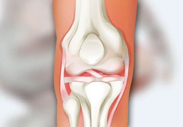 Anatomia stawu kolanowego: kości udowa i piszczelowa, rzepka oraz więzadła.