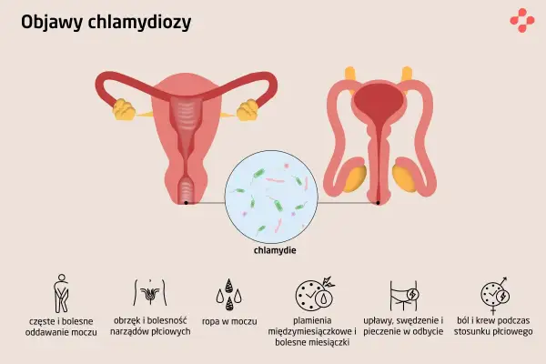 Ilustracja przedstawia układ rozrodczy kobiety i mężczyzny, powiększenie z bakteriami chlamydii oraz ikony symbolizujące objawy chlamydiozy: ból przy oddawaniu moczu, obrzęk narządów płciowych, ropę w moczu, plamienia i bolesne miesiączki, upławy, swęd...