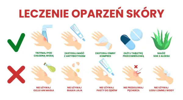 Instrukcja leczenia oparzeń skóry: chłodna woda, maść z antybiotykiem, zimny kompres, leki przeciwbólowe, aloes. Unikaj masła, jajka, pasty do zębów, lodu.