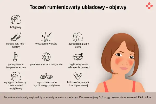 Pierwsze objawy tocznia: ból głowy, obrzęki, wypadanie włosów, owrzodzenia jamy ustnej, gorączka, utrata wagi, zmęczenie, wysypka motylkowa, problemy psychiczne, bóle stawów.