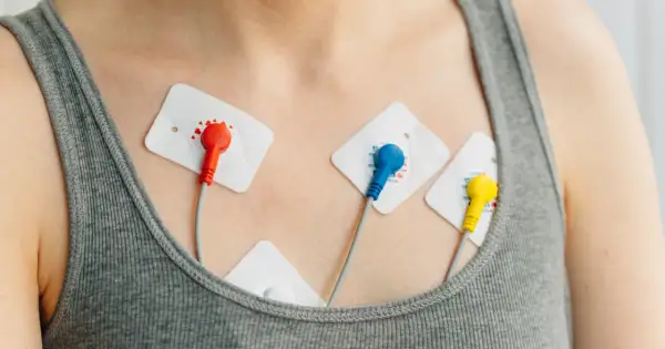 Elektrody EKG na klatce piersiowej, monitorujące pracę serca w celu wykrycia arytmii.